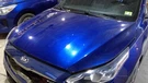 (local Pickup Only) Hood Sedan Fits 19-24 Forte 1034232. Fixed Price $299.90.